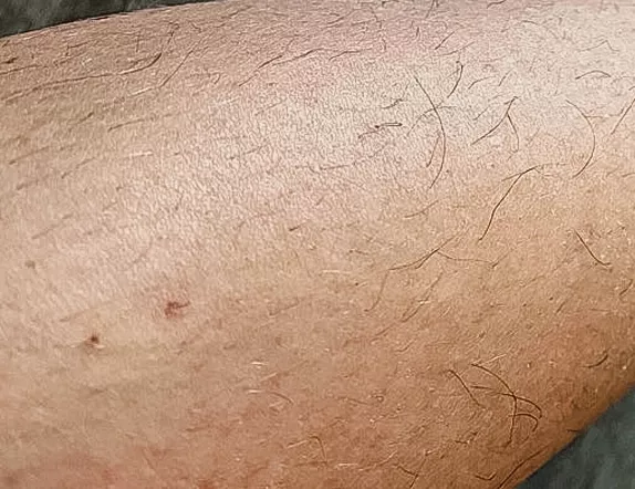 Image #4 from bestienztan