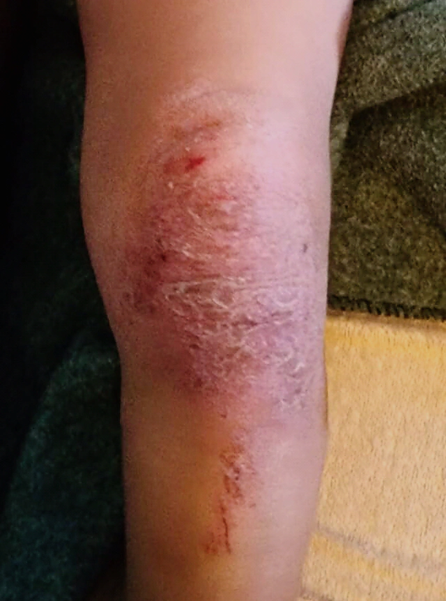 Image #1 from pandeon